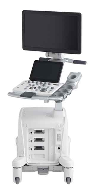 超音波診断装置